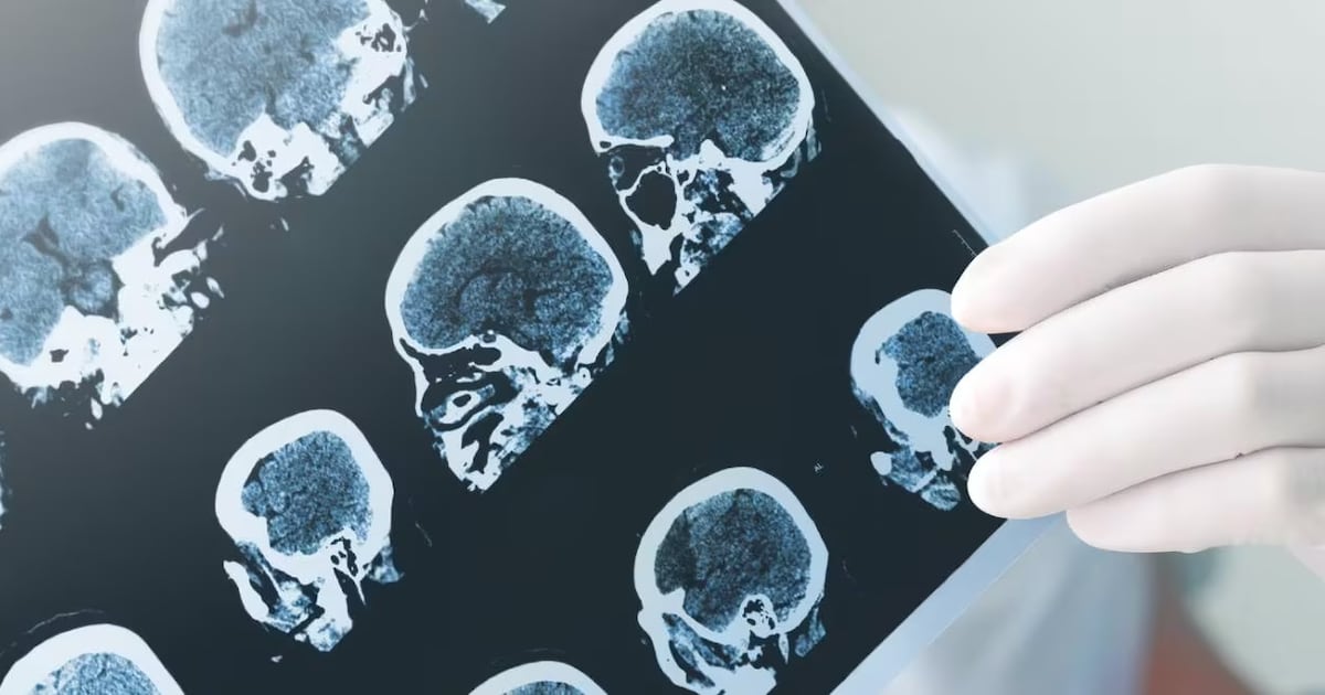 Bayer is leveraging Google Cloud to develop AI applications for radiology